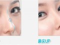无鼻托镜眼距怎么调整，无鼻托眼镜框