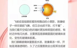 视康日夜型怎么摘，视康日夜型怎么样